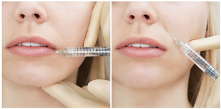 injectables-320-width